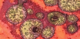 Study: Study findings can immediately be applied to human patients with the disease — (Details)