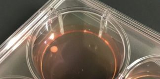 Study: What sets primates apart from other mammals? (Details)