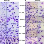 Study: Natural compound 2HF treats leishmaniasis infections, study finds — (Details)