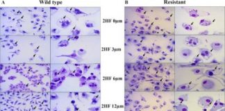 Study: Natural compound 2HF treats leishmaniasis infections, study finds — (Details)