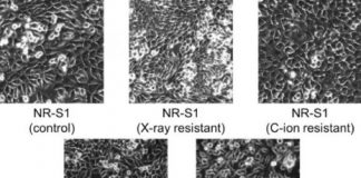 Study: Cancer cells distinguished by artificial intelligence-based system — (Details)