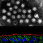 Study: New cells for norovirus production in the lab — (Details)