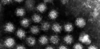 Study: New cells for norovirus production in the lab — (Details)