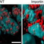 Study: Discovery of new neural mechanism underlying anxiety points to possible treatments — (Details)