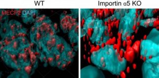 Study: Discovery of new neural mechanism underlying anxiety points to possible treatments — (Details)