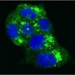 Study: New discoveries predict ability to forecast dementia from single molecule — (Details)