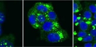 Study: New discoveries predict ability to forecast dementia from single molecule — (Details)