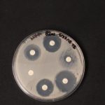 Study: Antimicrobial chemical tied to antibiotic resistance genes in dust — (Details)