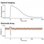 Study: Technique could be used to monitor visual function through the optic nerve in the eye — (Details)