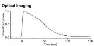 Study: Technique could be used to monitor visual function through the optic nerve in the eye — (Details)