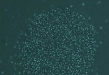 Research: A routine check revealed a previously undocumented behavior in the intestinal parasite —