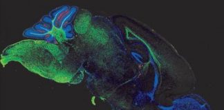 Study: New understanding of molecular underpinnings points to need for more aggressive treatment and earlier — (Details)