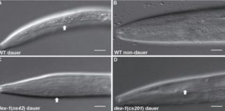 Research: Protein involved in nematode stress response identified —