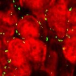 Study: How marijuana may damage teenage brains in study using genetically vulnerable mice — (Details)