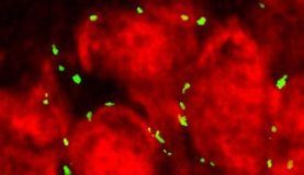 Study: How marijuana may damage teenage brains in study using genetically vulnerable mice — (Details)