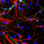 Study: Two-step control mechanism identified in mouse stem cells — (Details)