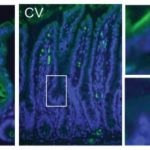 Study: Gut microbiome regulates the intestinal immune system — (Details)
