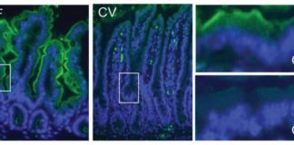 Study: Gut microbiome regulates the intestinal immune system — (Details)