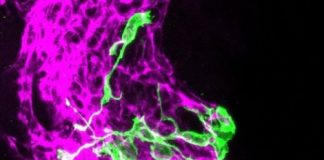 Study: Why our sense of smell declines in old age — (Details)