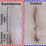 Study: E-bandage generates electricity, speeds wound healing in rats — (Details)