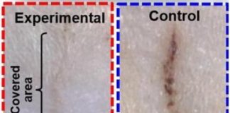 Study: E-bandage generates electricity, speeds wound healing in rats — (Details)