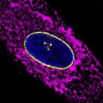 Study: Researchers analyze skin cells from more than 100 people of different ages to find molecular signatures that change as people get older — (Details)