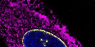 Study: Researchers analyze skin cells from more than 100 people of different ages to find molecular signatures that change as people get older — (Details)