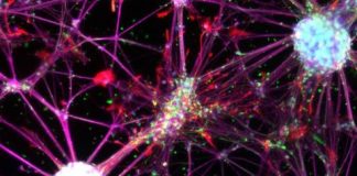 Study: Human blood cells can be directly reprogrammed into neural stem cells — (Details)