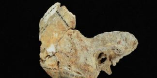 Research: Surfer’s ear points to ancient pearl divers in Panama —