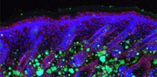 Study: How skin ages, loses fat and immunity — (Details)