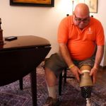 Study: Researchers find life-altering benefits to surgery developed for advanced prosthetics — (Details)