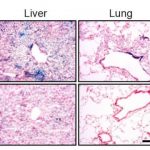 Study: Helping the immune system clear away old cells in aging mice helped restore youthful characteristics — (Details)