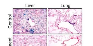 Study: Helping the immune system clear away old cells in aging mice helped restore youthful characteristics — (Details)