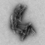 Study: Findings could lead to early diagnosis, better treatment studies — (Details)