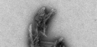 Study: Findings could lead to early diagnosis, better treatment studies — (Details)