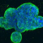 Study: An errant editing enzyme promotes tumor suppressor loss and leukemia propagation — (Details)