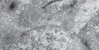 Research: Discovery in cell development changes understanding of how genes shape early embryos —