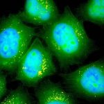 Study: Patients with lung disease could find relief by breathing in messenger RNA molecules — (Details)