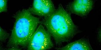 Study: Patients with lung disease could find relief by breathing in messenger RNA molecules — (Details)