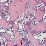 Study: If harnessed in people, it could speed recovery for bone breaks, spinal fusions, osteoporosis — (Details)