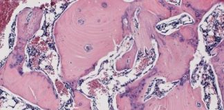 Study: If harnessed in people, it could speed recovery for bone breaks, spinal fusions, osteoporosis — (Details)