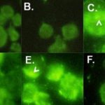 Study: New biomarker for colorectal cancers Identified — (Details)