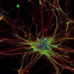 Study: Neurons from people with autism exhibit different patterns of growth and develop at a faster rate — (Details)