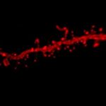 Study: Exposure to cannabis and stress in adolescence can lead to anxiety disorders in adulthood — (Details)