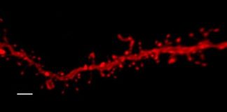 Study: Exposure to cannabis and stress in adolescence can lead to anxiety disorders in adulthood — (Details)