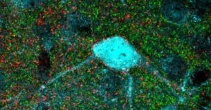 Study: Brain plasticity restored in adult mice through targeting specific nerve cell connections — (Details)