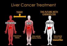 Tech: Absorbent polymer sops up chemotherapy drugs from bloodstream after treatment — (Report)