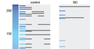 Study: Findings could help inform new therapies, improve diagnosis — (Details)