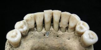 Study: Analysis of the fossilized dental plaque of a medieval woman reveals lapis lazuli, suggesting she was an accomplished painter of illuminated manuscripts — (Details)