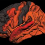 Study: Toxic brain protein tau elevated in older people who sleep poorly — (Details)